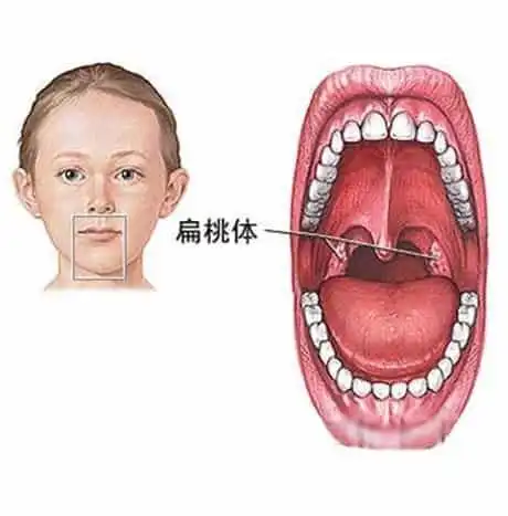 扁桃体
