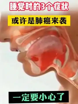 女性尖锐湿疣,劝你3个行为,千万别再做了尖锐湿you热点知识科普科普一下
