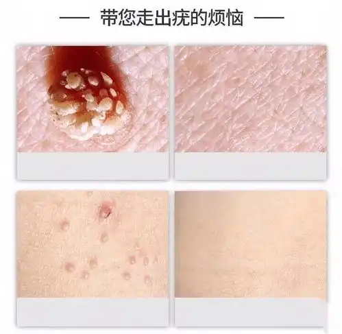 真假菜花的区别快来围观
